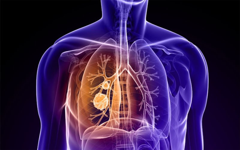 Ăn hành lá có lợi gì cho sức khỏe và các tác dụng của hành?