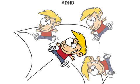 Bệnh tăng động là gì và nguyên nhân dẫn đến bệnh tăng động?