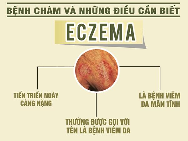 Bệnh Chàm Là Gì? Tìm Hiểu Về Bệnh Chàm Là Gì?