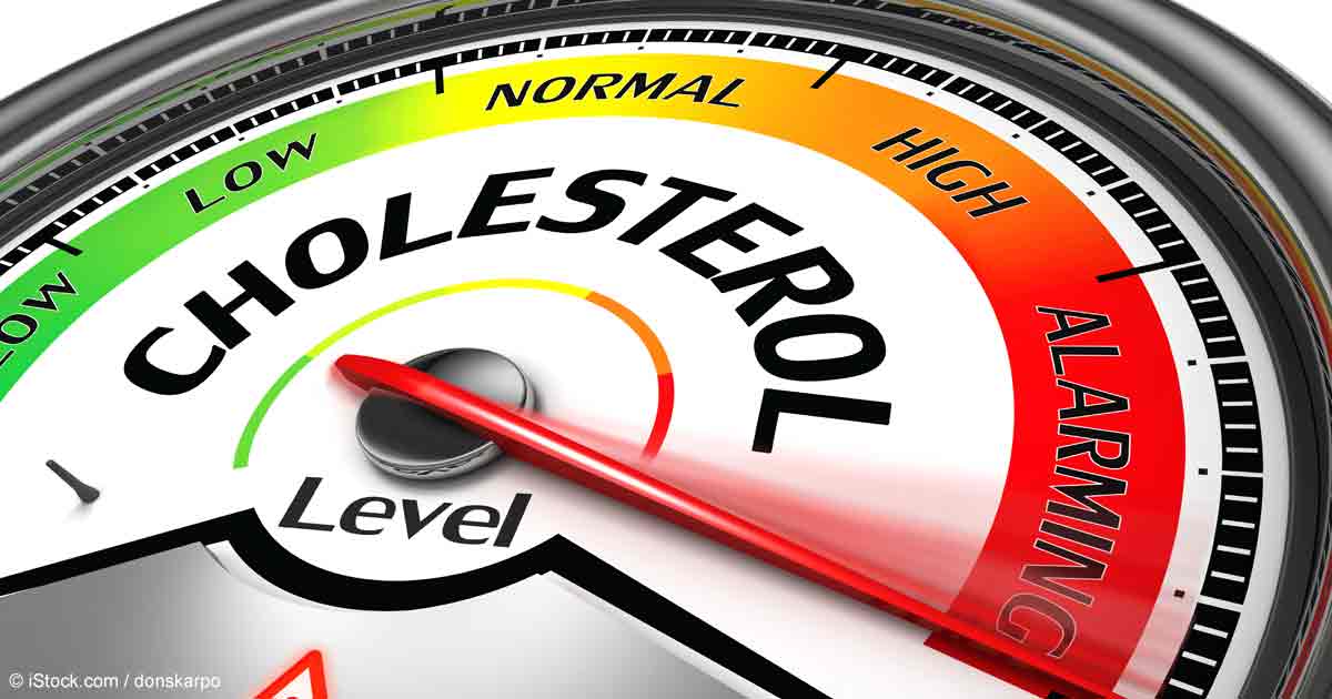 Cholesterol Là Gì? Tìm Hiểu Về  Cholesterol Là Gì?