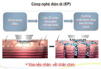 Công nghệ điện di là gì?