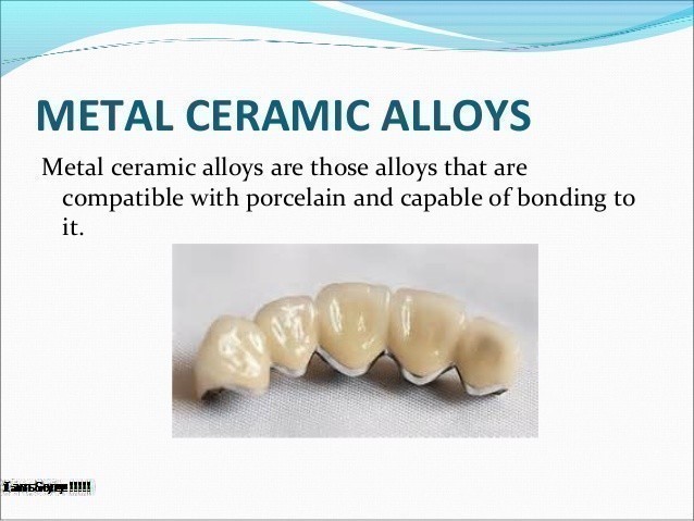 Hợp Kim Gốm Là Gì? Tim Hiểu Hợp Kim Gốm Là Gì?