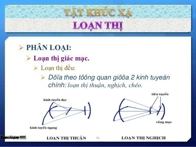 Loạn thị là gì và những tác hại của bệnh loạn thị gây ra?