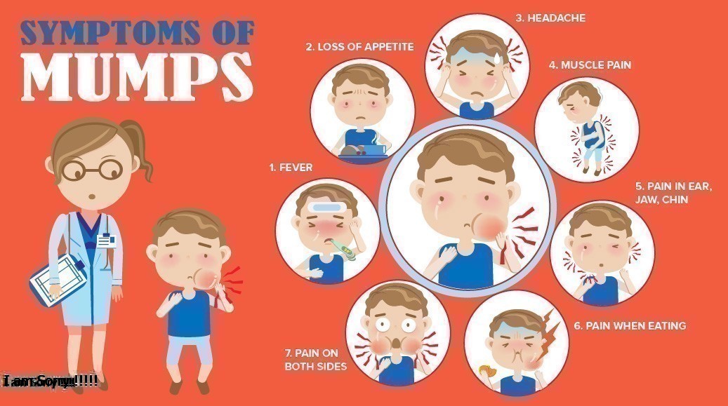 Mumps Là Gì? Tìm Hiểu Về Mumps Là Gì?