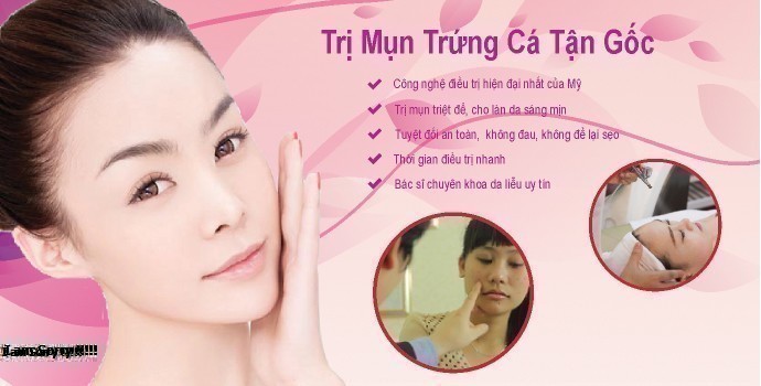 Mụn Là Gì? Tìm Hiểu Về Mụn Là Gì?