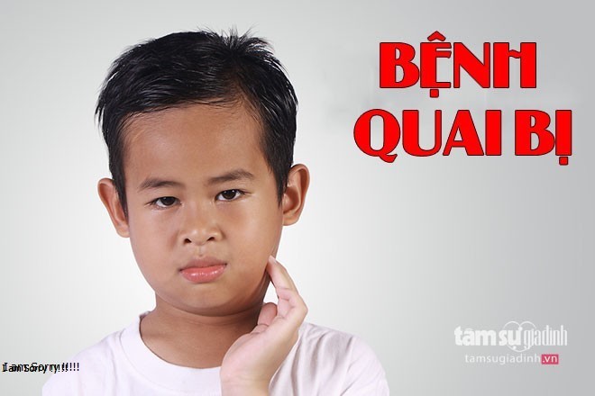 Quai Bị Là Bệnh Gì? Tìm Hiểu Về Quai Bị Là Bệnh Gì?