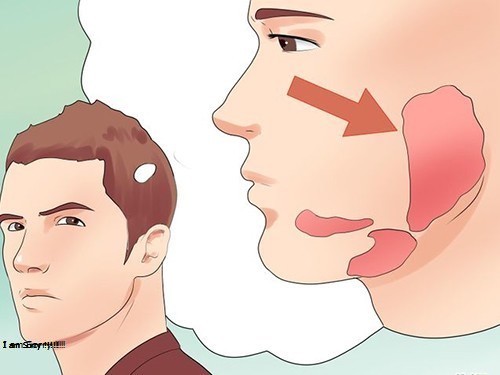 Quai Bị Là Bệnh Gì? Tìm Hiểu Về Quai Bị Là Bệnh Gì?