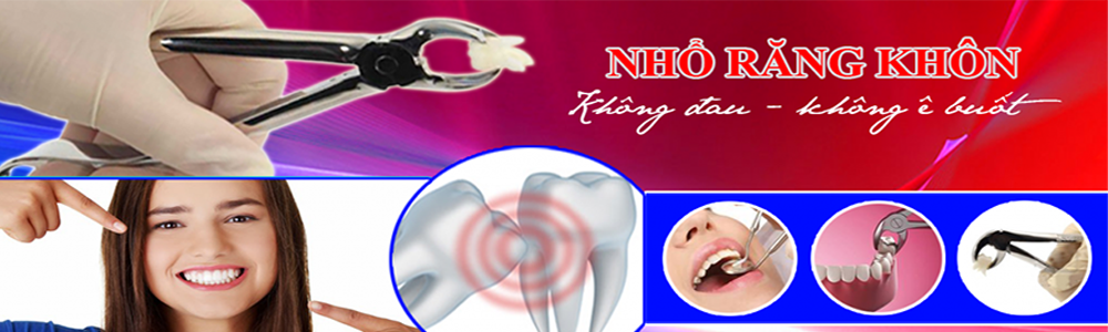 Răng Khôn Là Gì? Tìm Hiểu Về Răng Khôn Là Gì?