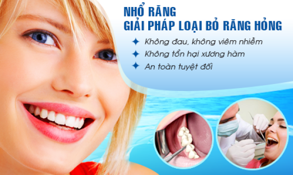Răng Khôn Là Gì? Tìm Hiểu Về Răng Khôn Là Gì?