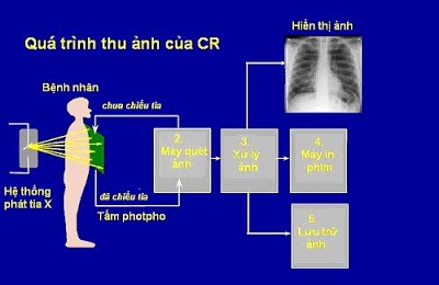 Tia Gamma là gì và một vài ứng dụng tia Gamma trong y học?