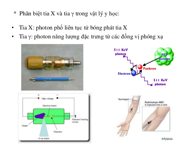 Tia X Là Gì? Tìm Hiểu Về Tia X Là Gì?