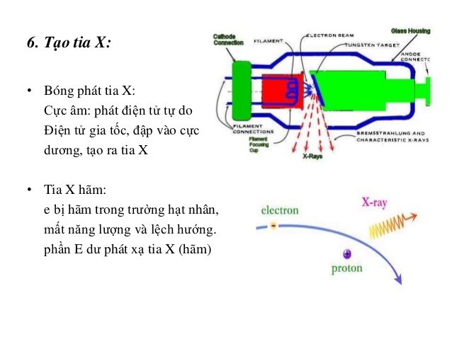 Tia X Là Gì? Tìm Hiểu Về Tia X Là Gì?