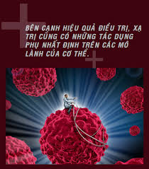 Xạ Trị Là Gì? Tìm Hiểu Về Xạ Trị Là Gì?