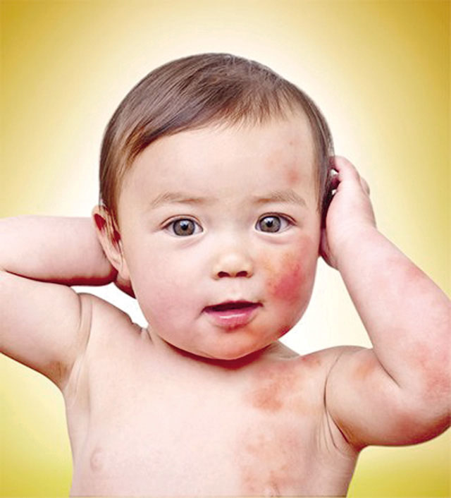 Các Bệnh Dễ Mắc Phải Khi thời Tiết Giao Mùa