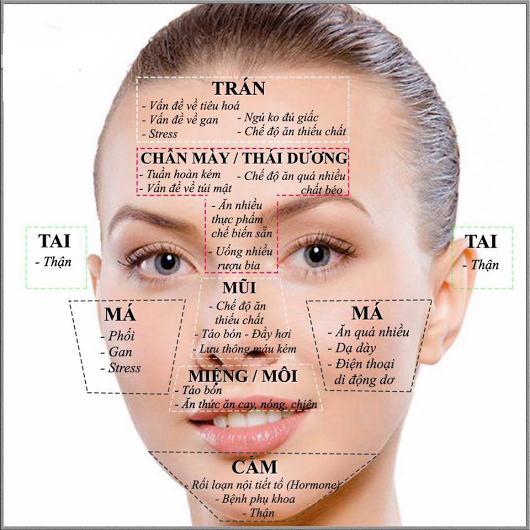 Nguyên nhân gây ra mụn trứng cá là do đâu?