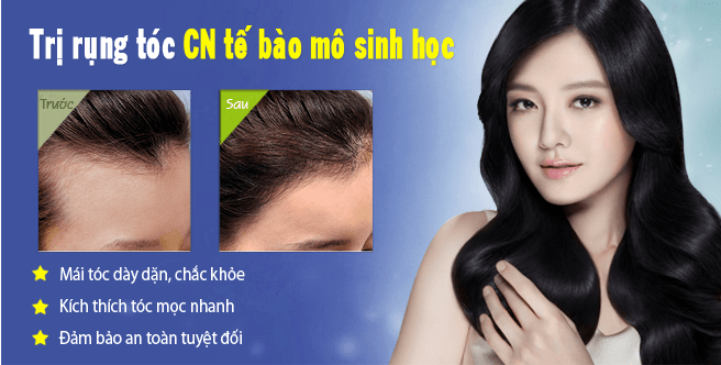 Bệnh Hói Đầu Là Gì? Cách Chữa Trị Nhanh Và Hiệu Quả