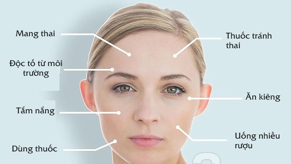 Tàn Nhang Là Gì? nguyên Nhân Và Cách Chữa Trị Tận Gốc