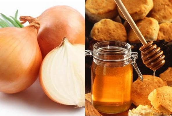 Trị Ho Dứt Điểm Sau 5 Ngày Nhờ Bài Thuốc Dân Gian Bằng Hành Tây