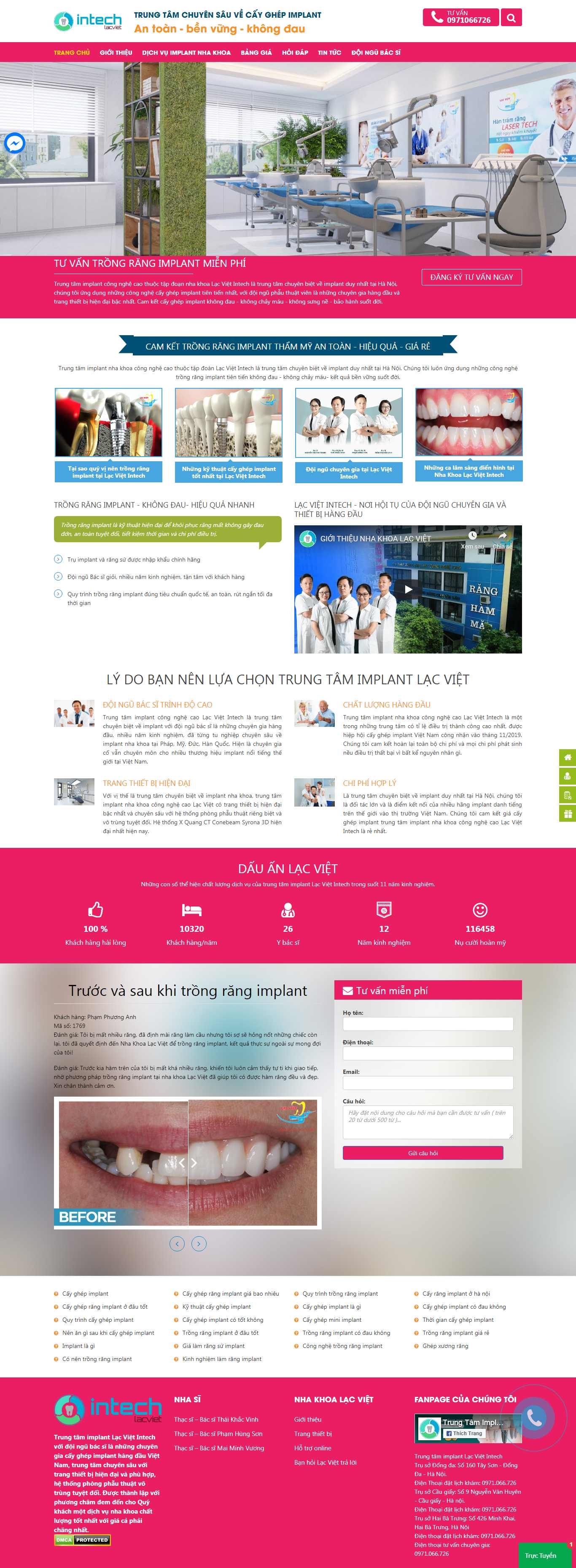 Thiết kế Web quảng bình lamrangimplant.com