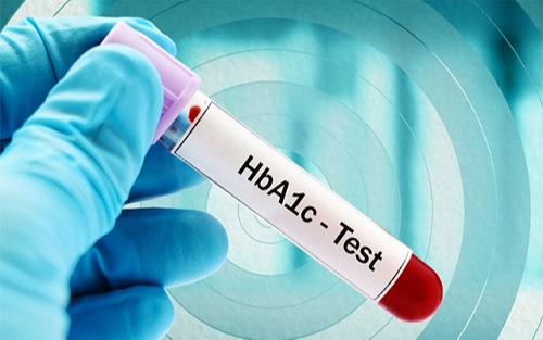 HbA1c là gì? Theo dõi chỉ số HbA1c như thế nào?