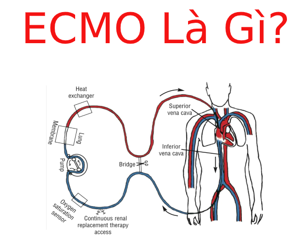 ECMO là gì? Cấu tạo hệ thống máy tim phổi nhân tạo