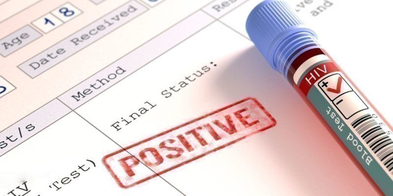 Cách phân biệt giữa Positive và Negative là gì?