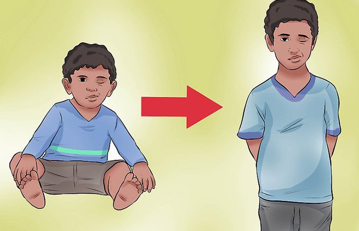 Rối Loạn Tic Là Gì? Triệu Chứng Của Bệnh Rối Loạn Tic Là Gì?