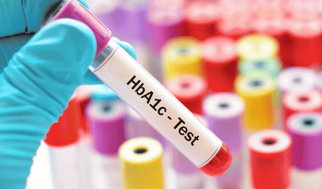 HbA1c là gì? Theo dõi chỉ số HbA1c như thế nào?